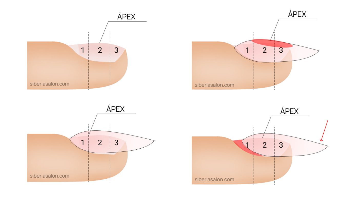Ápex de uñas